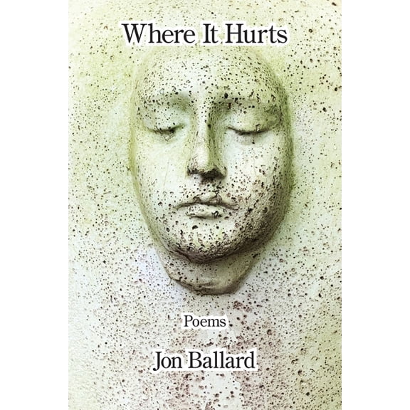 Where It Hurts, (Paperback)