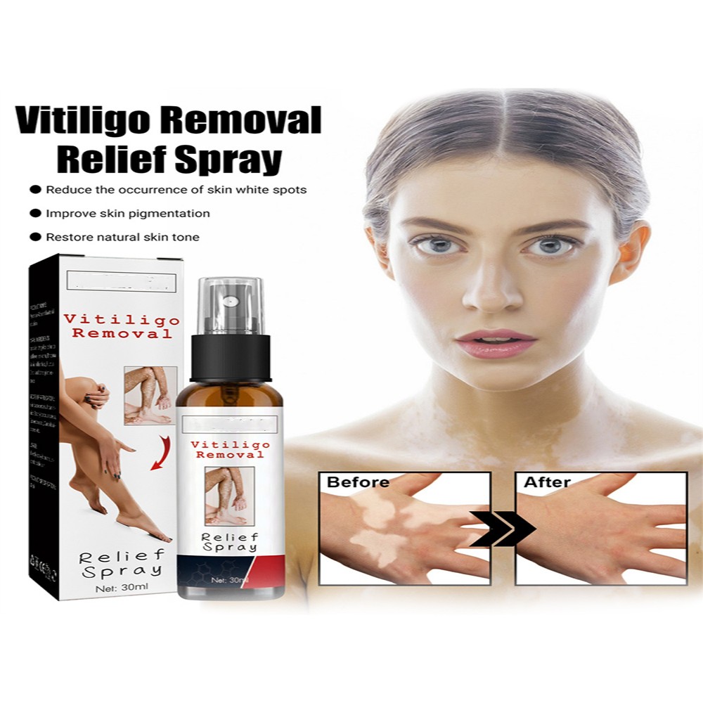 White Spot Repair Spray Repair Desalination White Spot Spotted Sweat