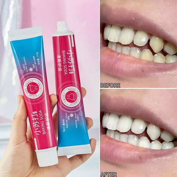 Whitening And Stain Removing Toothpaste Oral White Teeth And Gums Toothpaste 110g