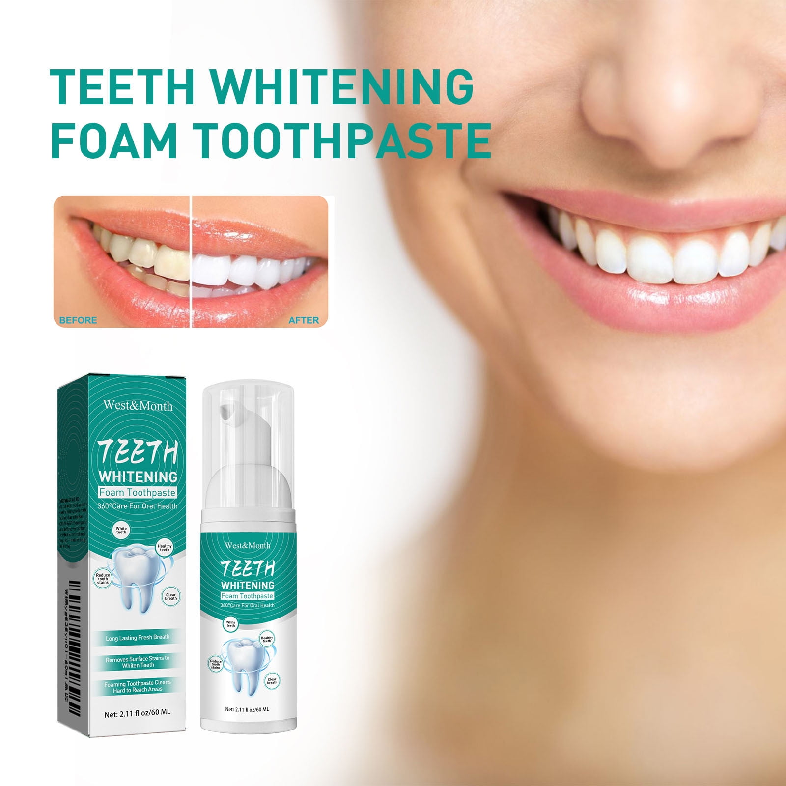 Whitening Teeth Mousse - Mild Formula for Stain Removal & Fresh Breath ...