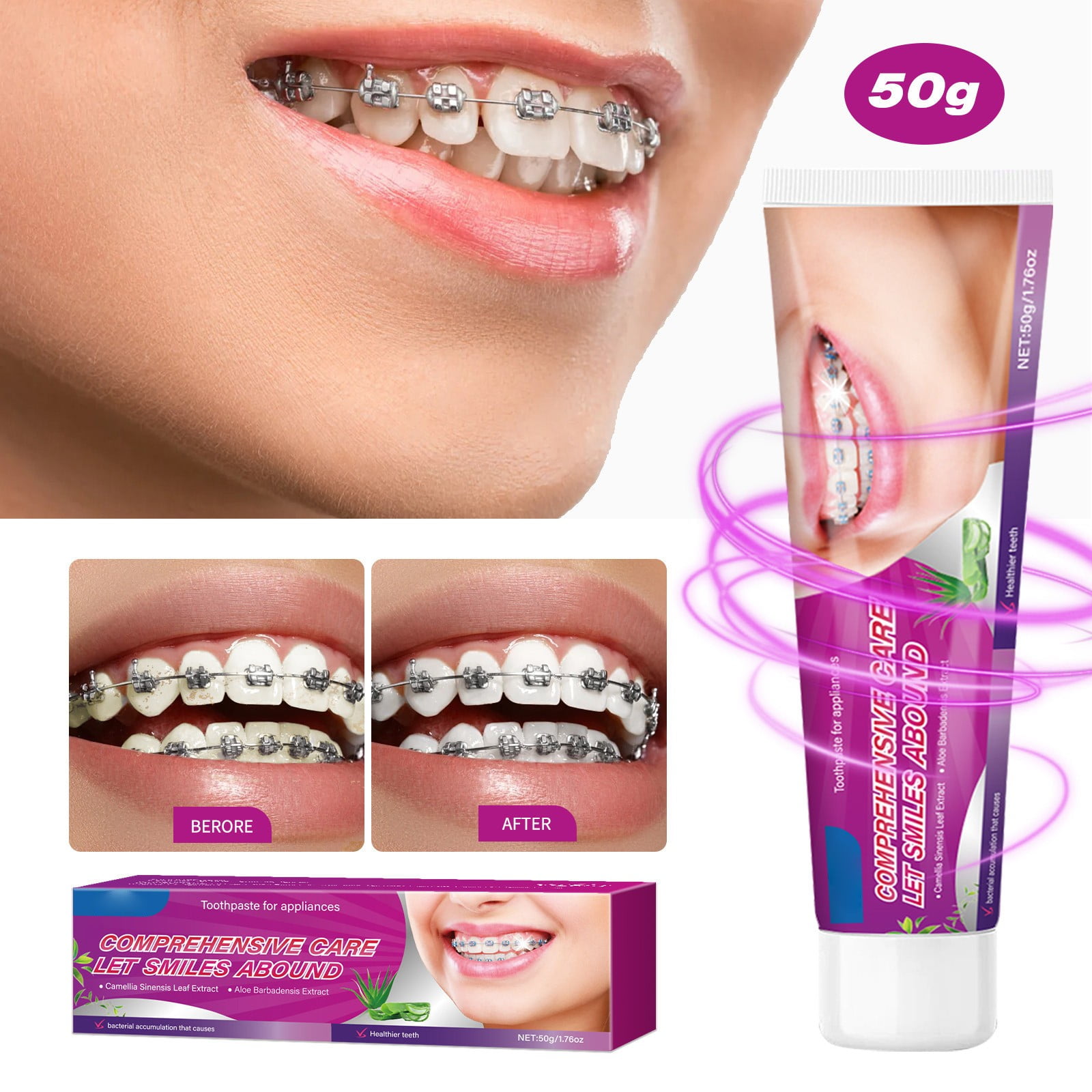 Whitening Toothpaste for Retainers Retainer Toothpaste – Deep Clean ...
