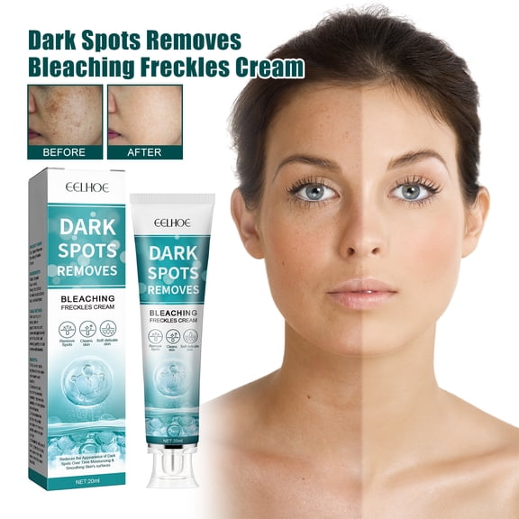 Whitening and Spot-Correcting Cream, Hydrating, Moisturizing Skin, Lightening Freckles, Acne, Brightening and Nourishing Cream