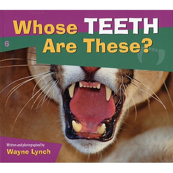 Pre-Owned Whose....is This?: Whose Teeth Are These? (Hardcover)