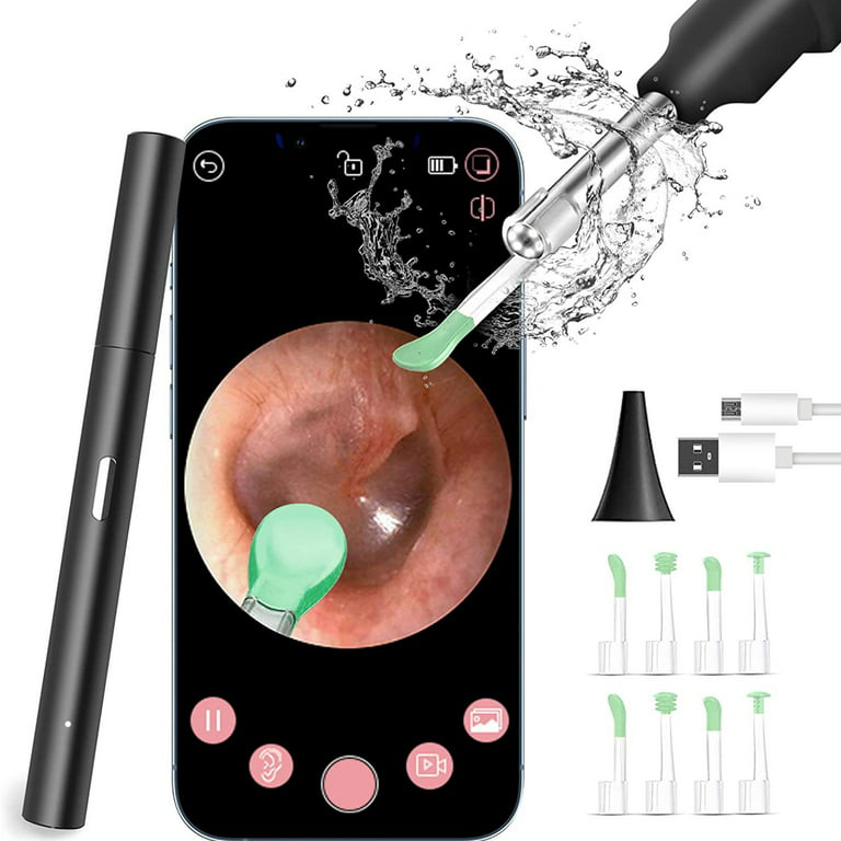 Wireless Ear Cleaner Otoscope Ear Wax Removal Tool with Camera LED Light  Wireless Ear Endoscope Ear Cleaning Kit for iphone - AliExpress