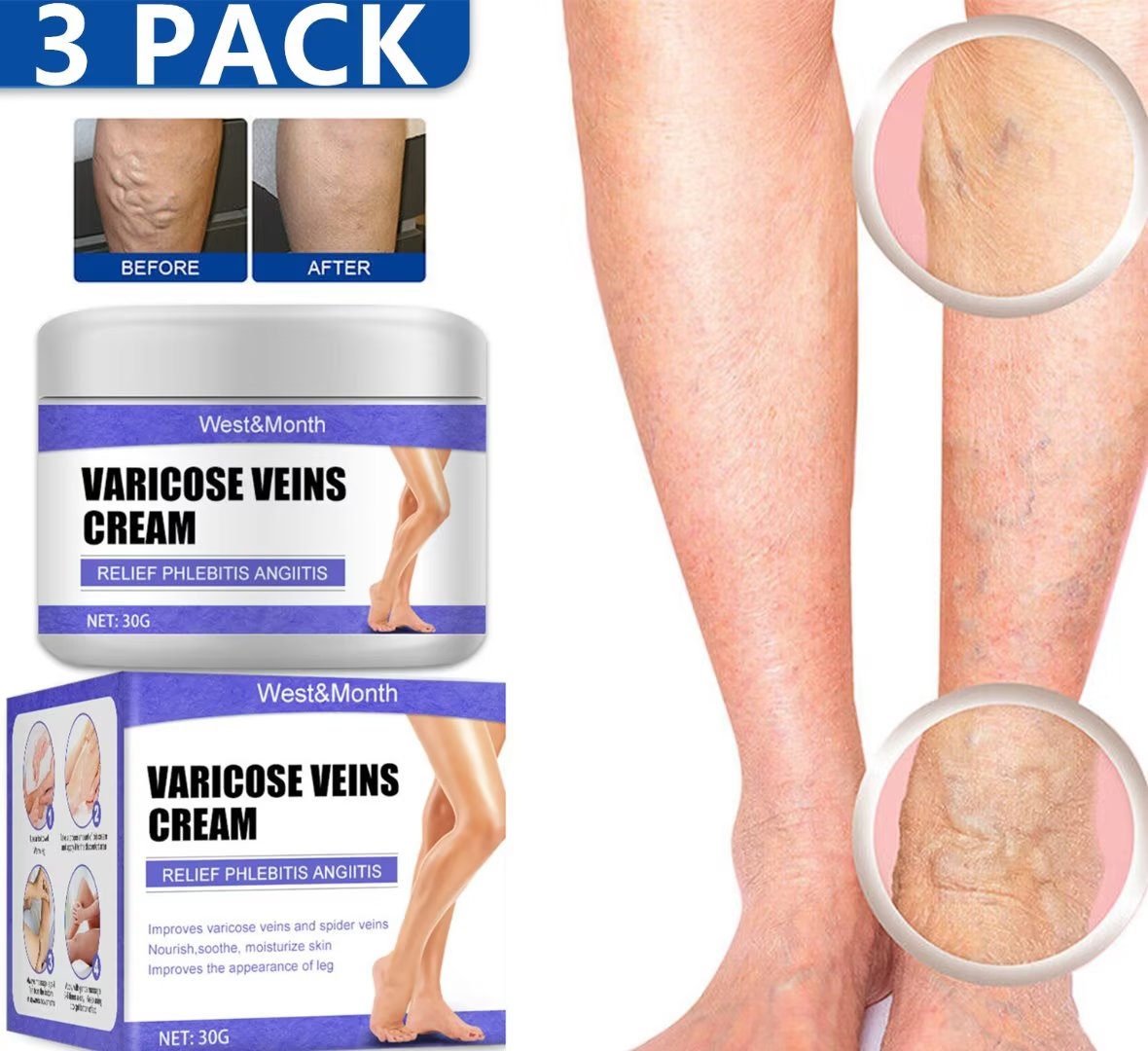 Wisdom 3 PACK 90G Varicose Veins Cream, Varicose Veins Treatment for