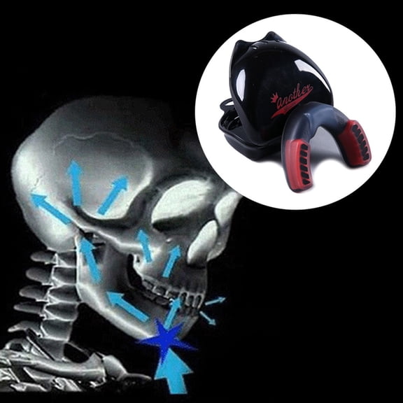 Wofarmy 2026 Professional Muay Thai Tooth Protection Eva Boxing Mouthguard Sports Teeth Braces Box Taekwondo Sanda Rugby Mma Mouth Guard Black Red L