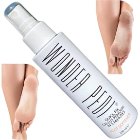 Wonder Pedi Instant Soft Foot Callus Remover Feet Softener Spray Professional Spa Quality