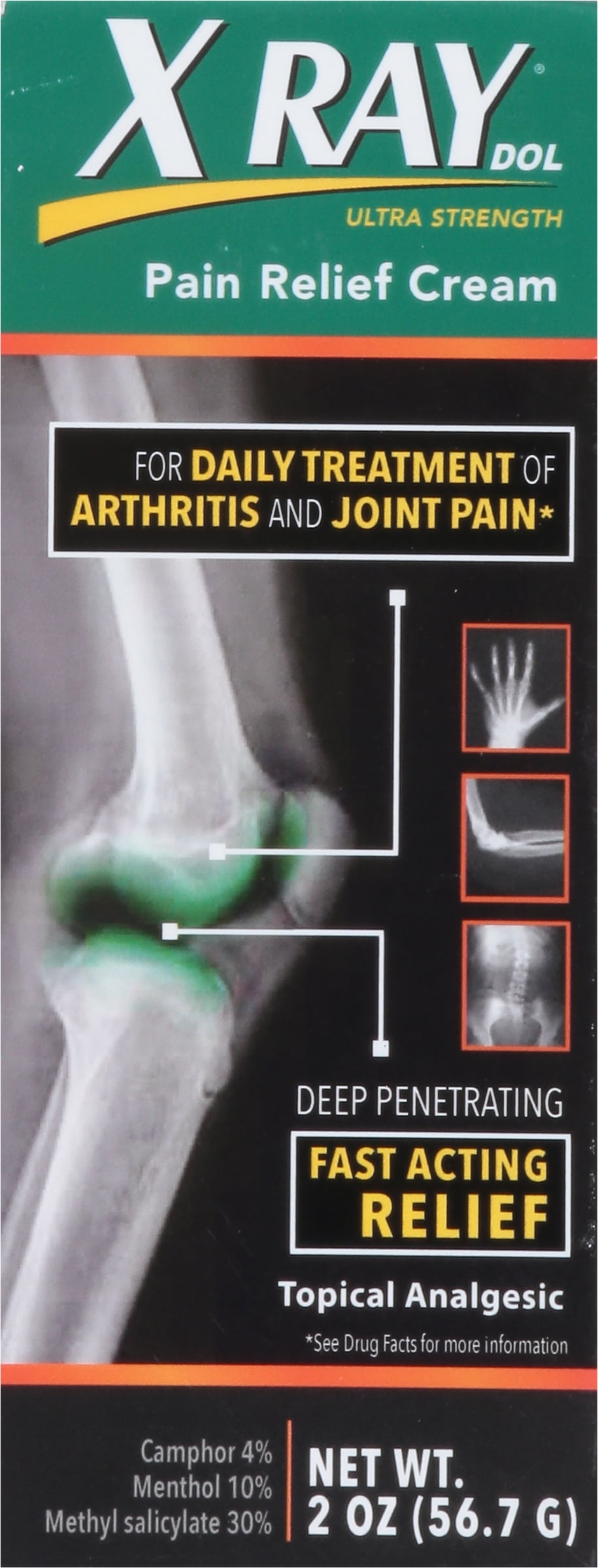 X Ray Dol Ultra Strength Pain Relief Cream. Topical Analgesic for Arthritis, Joint and Muscle Pain. 2 oz