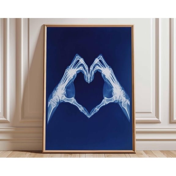 X Ray Heart Hands Anatomical Wall Art Print, Unframed Paper Poster 8x10in
