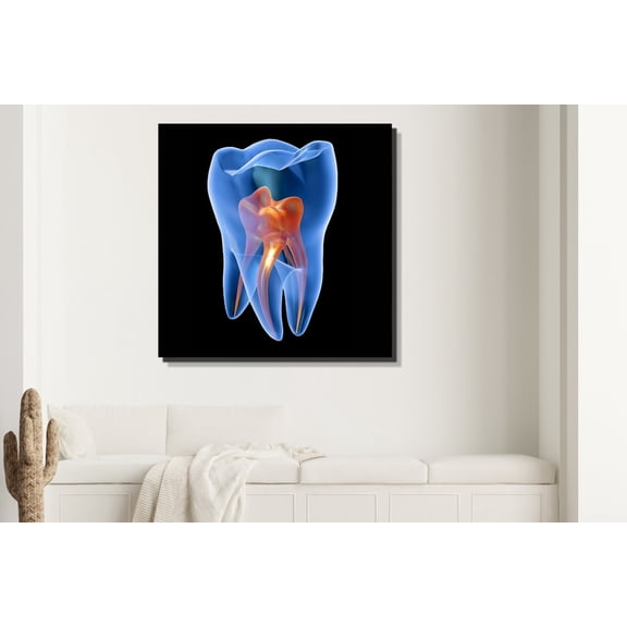 X-Ray Molar Tooth Wall Art Print, Unframed Paper Poster 8x10in