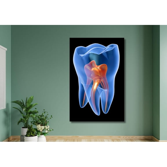 X-Ray Molar Tooth Wall Art Print, Unframed Paper Poster 8x10in