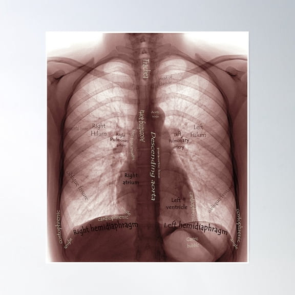 X Ray Poster Wall Art, Modern Wall Decor, 8x12 UNFRAMED