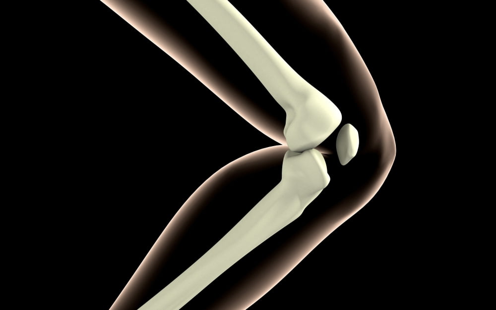 X-ray image of knee Canvas Art - Stocktrek Images (36 x 23)