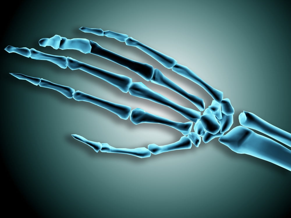 X-ray view of bones in human hand Canvas Art - Stocktrek Images (17 x 13)