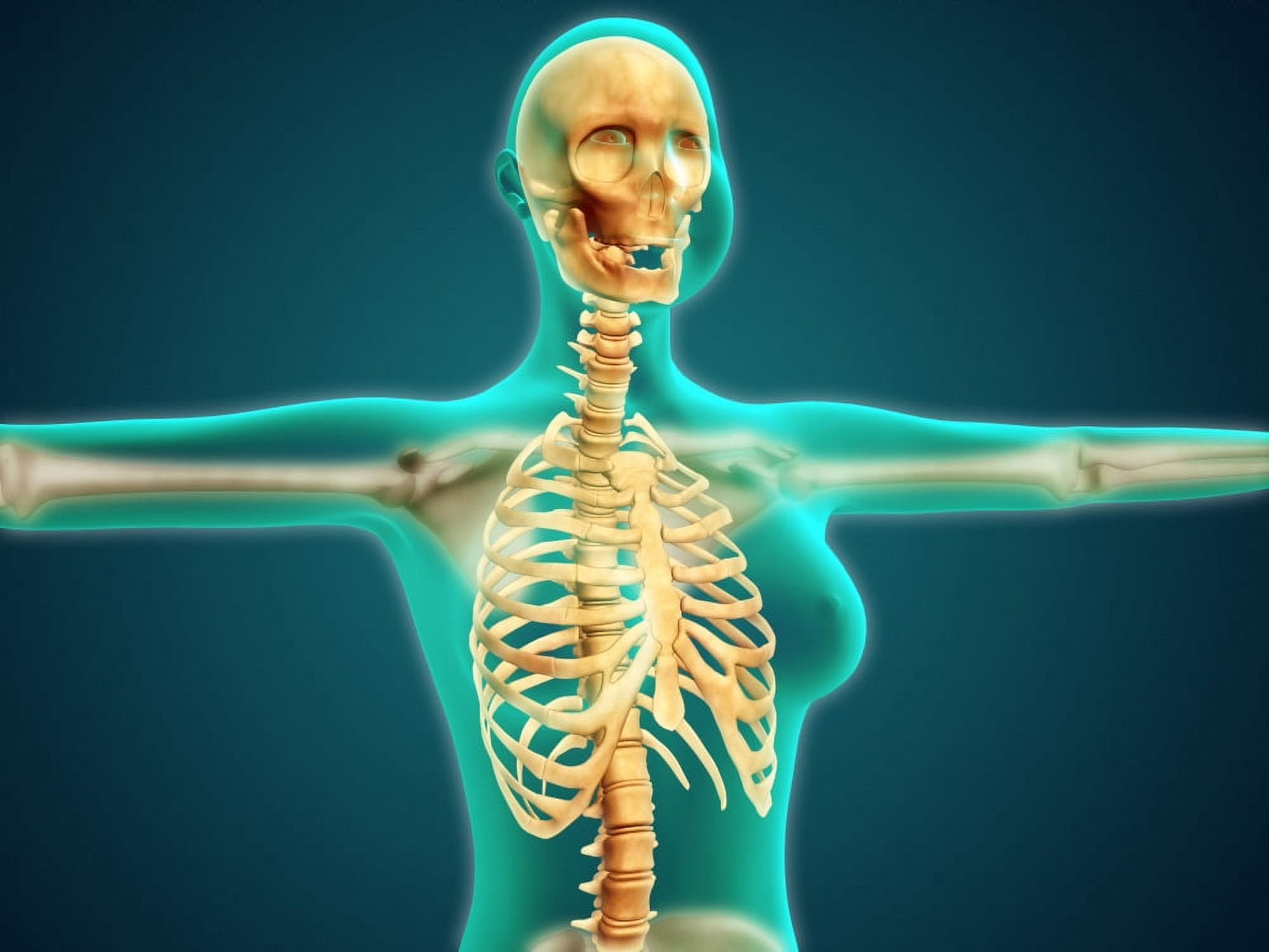 X-ray view of female upper body showing rib cage spine and skull Canvas Art - Stocktrek Images (17 x 13)