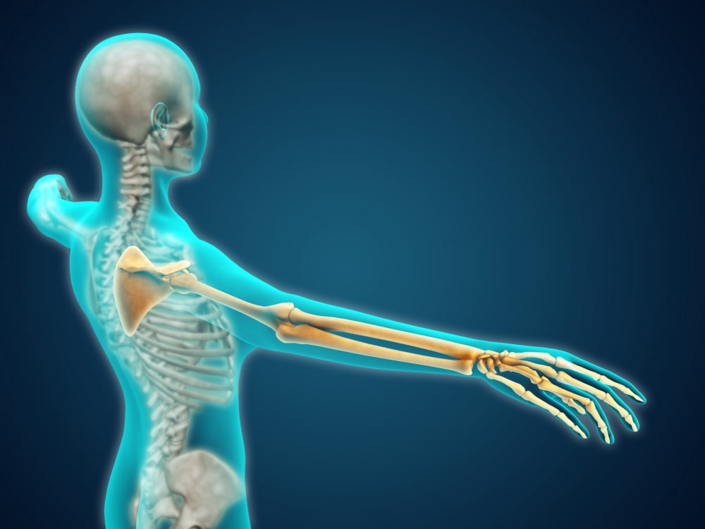 X-ray view of human body showing skeletal bones in the arm and hand Canvas Art - Stocktrek Images (17 x 13)