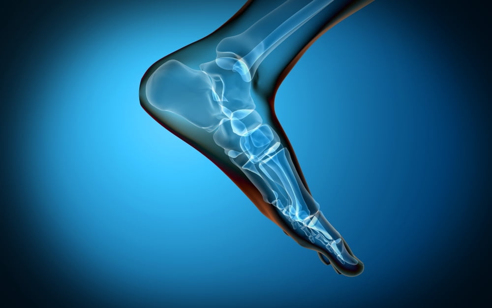 X-ray view of human foot Canvas Art - Stocktrek Images (18 x 12)