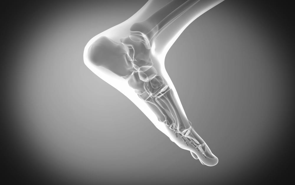 X-ray view of human foot Canvas Art - Stocktrek Images (18 x 12)