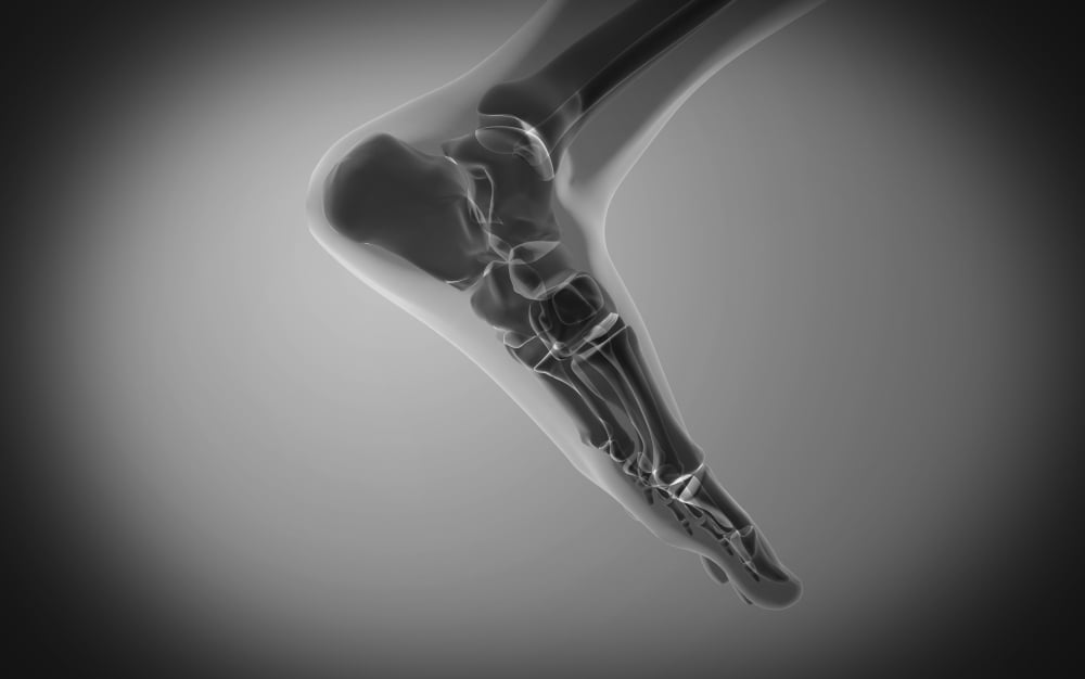 X-ray view of human foot Canvas Art - Stocktrek Images (36 x 23)