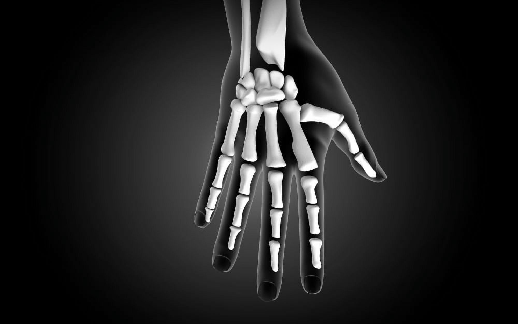 X-ray view of human hand Canvas Art - Stocktrek Images (36 x 23)