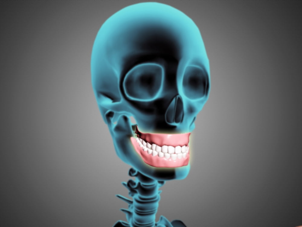 X-ray view of human skeleton showing teeth and gums Canvas Art - Stocktrek Images (17 x 13)