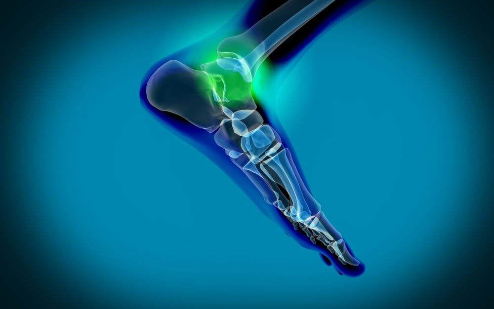X-ray view of pain in human foot Canvas Art - Stocktrek Images (18 x 12)
