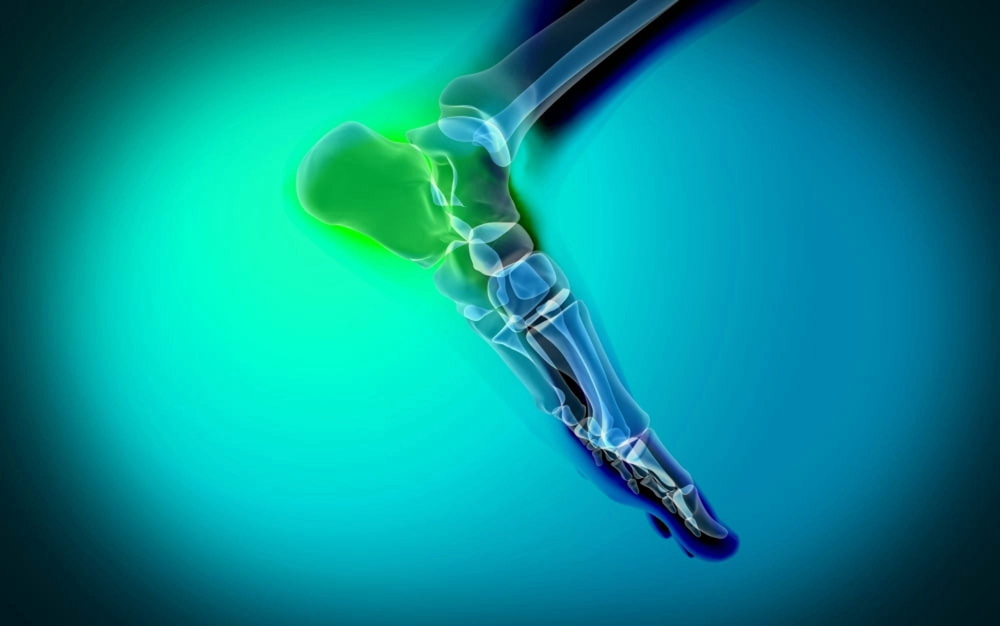 X-ray view of pain in human foot Canvas Art - Stocktrek Images (36 x 23)