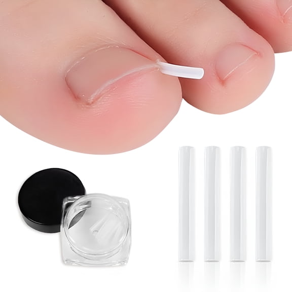 XIRQI 10 Pcs Toenail Correction Patches, Medical Grade Plastic Ingrown Nail Straightener, Adjustable Foot Repair Treatment for Curved Nails