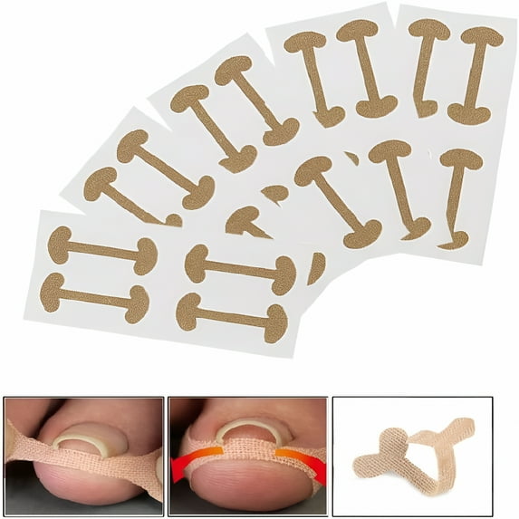 XIRQI 2026 New 20 Pcs Ingrown Toenail Kit,Breathable Self-Adhesive Ingrown Toenail Treatment Elastic Patch Corrector Pedicure Tools Fingernail Care Protects Toe Nail Stickers 5 Sheets