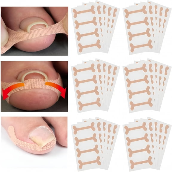 XIRQI 60 Sheets Clear Toenail Correction Patches, Breathable Ingrown Nail Straightener Bandages for Home and Salon Foot Care