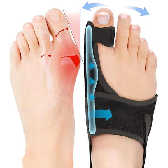XIRQI Bunion Corrector For Women Big Toe Straightener Orthopedic Bunion Splint Non Hallux Valgus Correction Hammer Toe Straightener Comfortable & Breathable For Day/Night