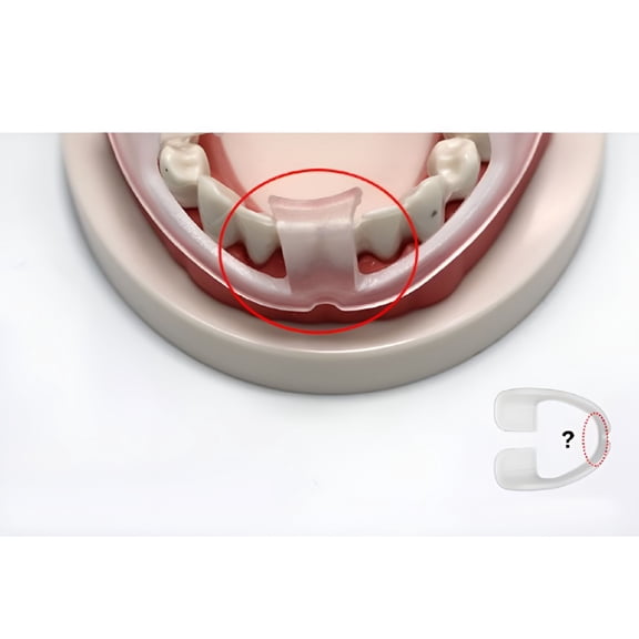 XIRQI Mouth Guard 3Pcs Dental Night Protector Dental Guard No More Teeth Grinding Food Grade EVA Mouth Guard,for Home,Travel,Sleep,Sports Use