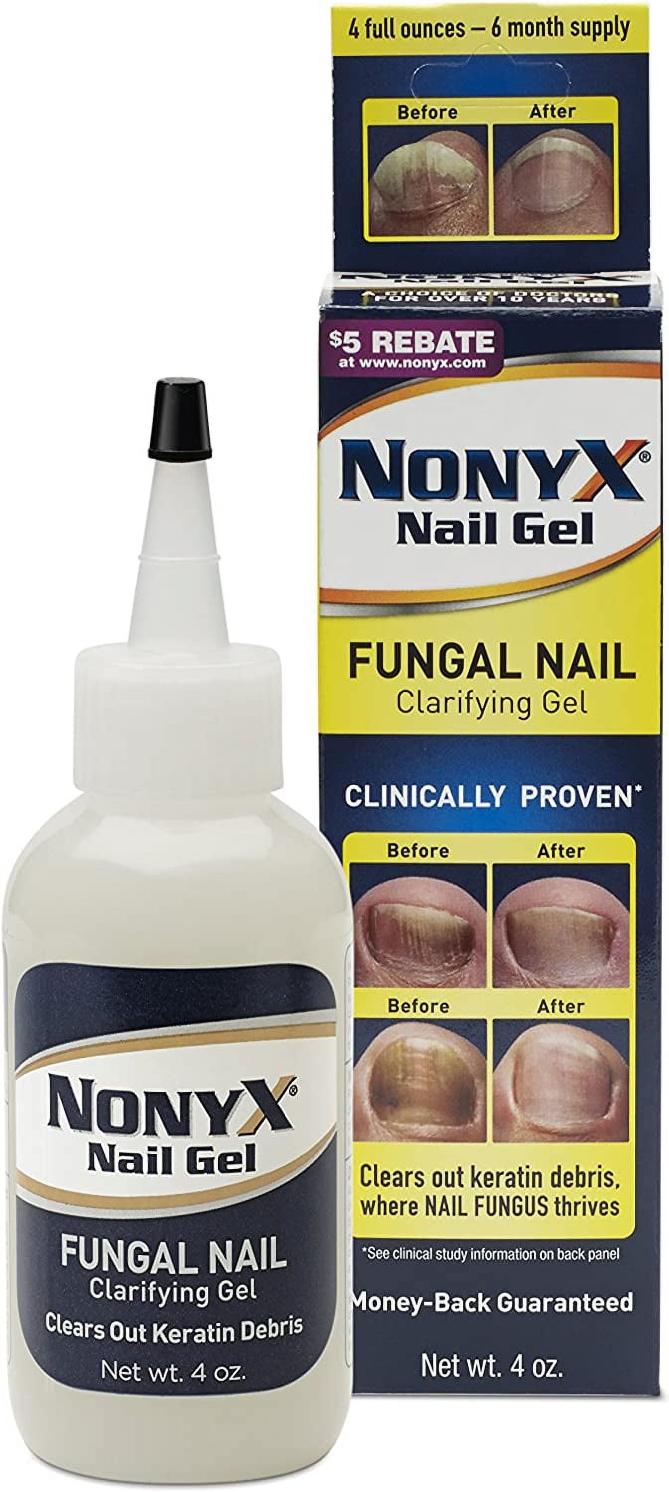 Xenna All Natural Nonyx Nail Gel For Toenails And Fingernails - 4 Oz