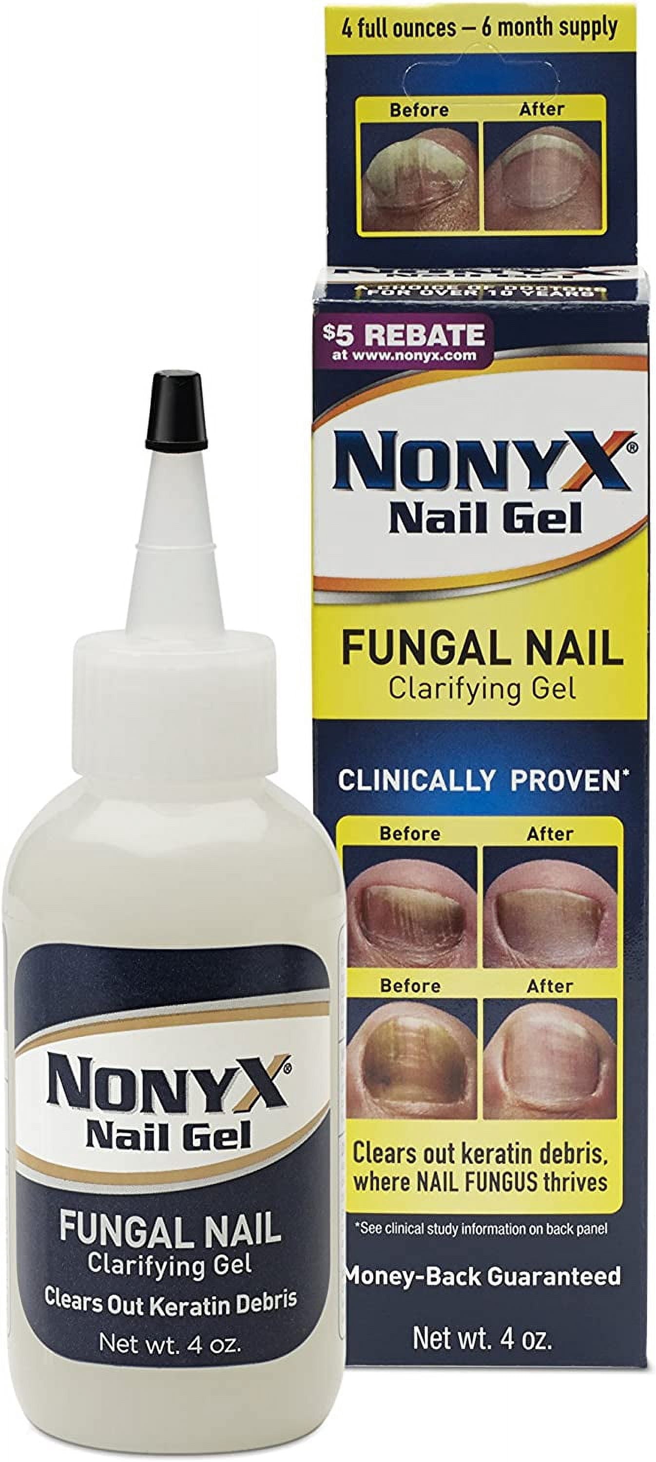 Xenna All Natural Nonyx Nail Gel for Toenails and Finger nails, 4 oz