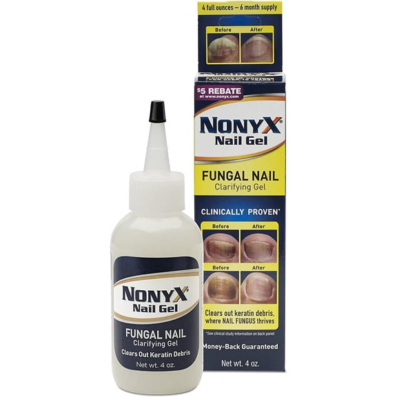 Xenna All Natural Nonyx Nail Gel for Toenails and Finger nails, 4 oz