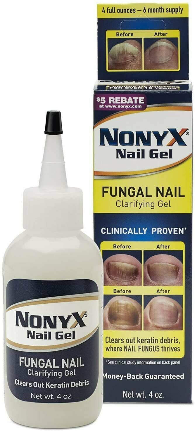 Xenna Xenna Nonyx Nail Gel, 4 oz (Pack of 3)