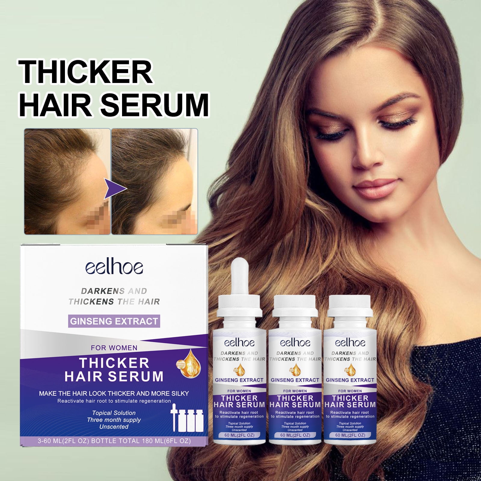 Xerdsx Hair Regrowth Treatment for Thinning Hair and Hair Loss, Topical