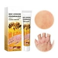 Ximonth Cowhide Care For Hand And Foot Skin Redness And Swelling