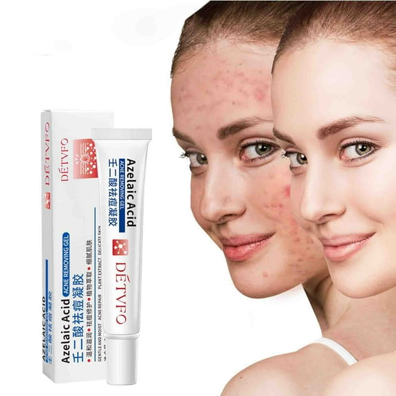 YFGEFTR Prescription-Strength Topical Retinoid Gel For Face, Helps Clear And Prevents And Clogged Pores