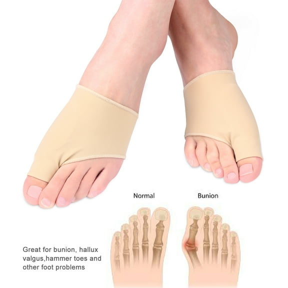 YOUTHINK Bunion Corrector And Bunion Relief Care Kit For Tailors Bunion,Yosoo Bunion Sleeve Protector Metatarsal Toe Pad Forefoot Cushion Socks Bunion Booties