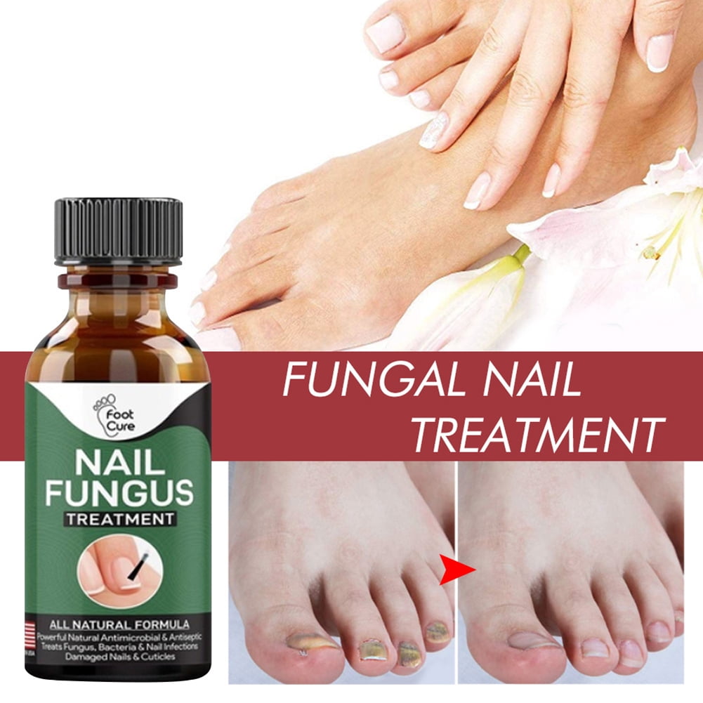 Buy AdiExpress nail fungus treatment, nail repair treatment, nail growth  oil, nail cream Online at Best Prices in India - JioMart.