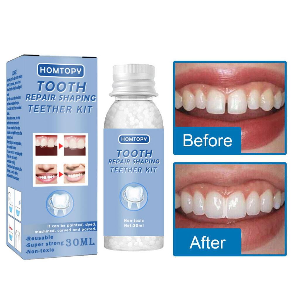 YUEYAN Temporary Dental Repair Kit for Broken or Missing Teeth Fake Filling and