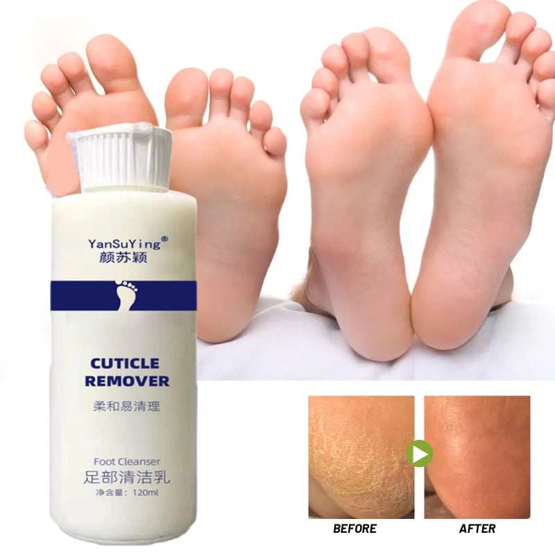 YanSuYing7 Seconds Foot Exfoliator Softener Removes Dead Skin and