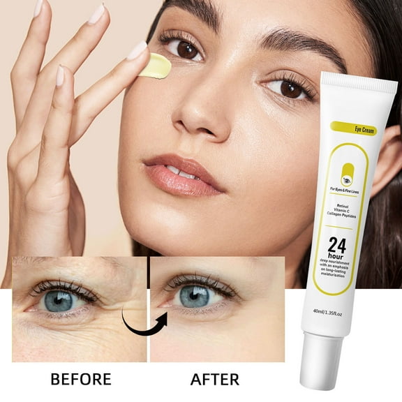 Yatlte Retinol Eye Cream - Eye Cream for Dark Circles, Anti Aging, with Hyaluronic Acid, Peptides, Caffeine, Reduces Bags, Smooths Wrinkles & Fine Lines, Dark Circles Under Eye Treatment