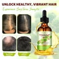 thumbnail image 1 of Yecuce Jamaican Black Castor Oil for Hair Care ,100% Pure & Natural,Dry Scalp Hydration -Nourishment Essential Oil(60ml/2.02fl.oz), 1 of 9
