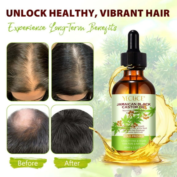 Yecuce Jamaican Black Castor Oil for Hair Care ,100% Pure & Natural,Dry Scalp Hydration -Nourishment Essential Oil(60ml/2.02fl.oz)