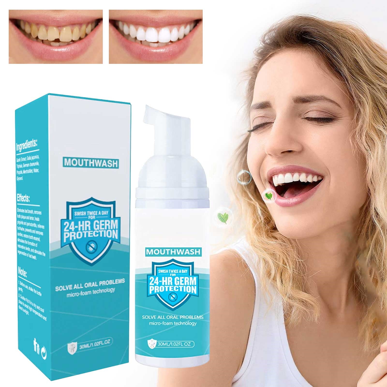 YehailoCleansing Clean Yellow Tooth Teeth Anti Tooth Decay Fresh Breath