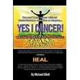 thumbnail image 1 of Yes I Cancer: You can't beat cancer without chemotherapy, radiation or surgery (Paperback) by Artritex Technologies, Michael Elliott, 1 of 1