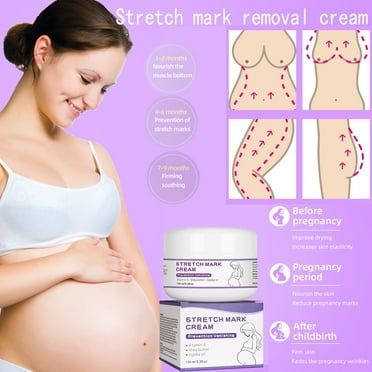 Yforlp Mommy Lapel Print Cream Prenatal Postpartum Pregnancy Stretch Mark Removal Cream