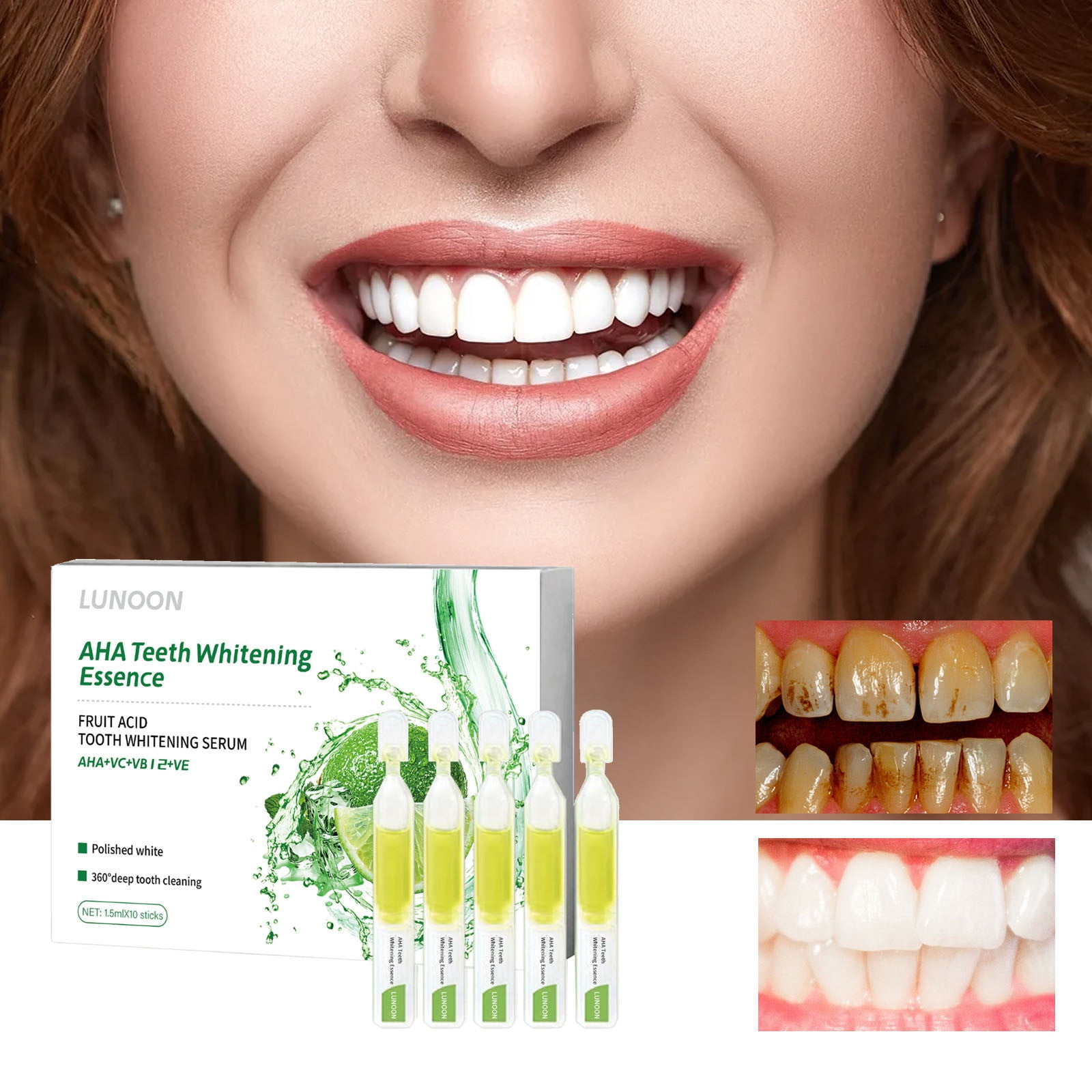 Yforlp Teeth Whitening Essence (1.5ml x 10 Sticks), Fruit Acid Tooth